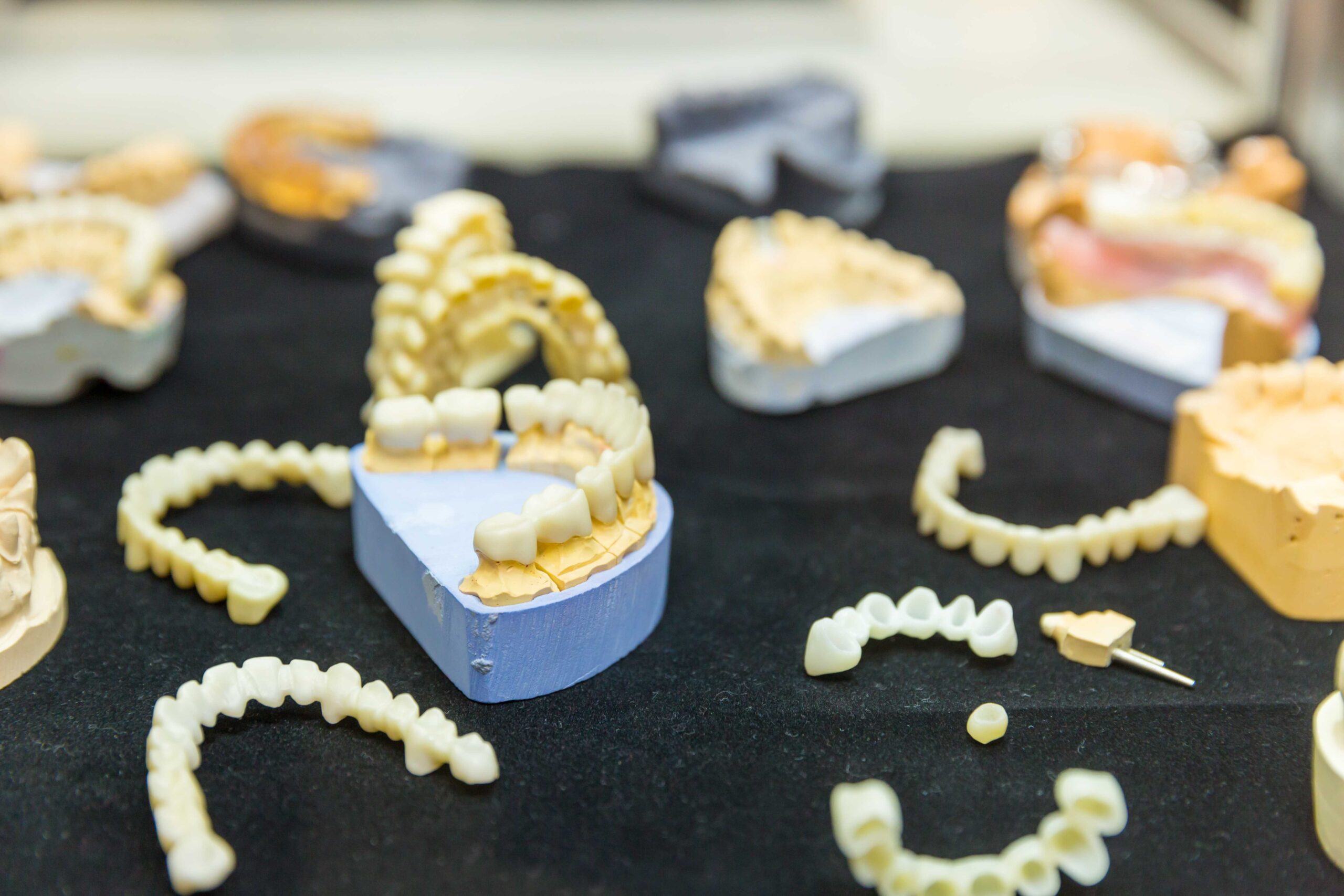 dental implants vs. dentures scaled