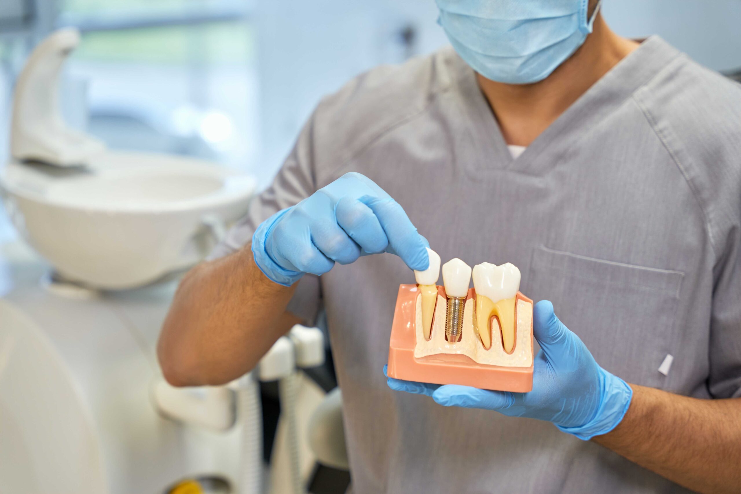 Dental implants on your oral health scaled