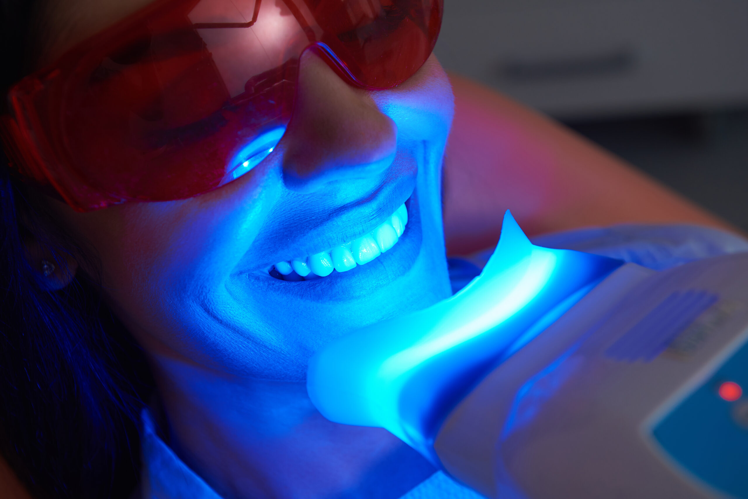 Professional vs. At-Home Teeth Whitening: Which to Choose?