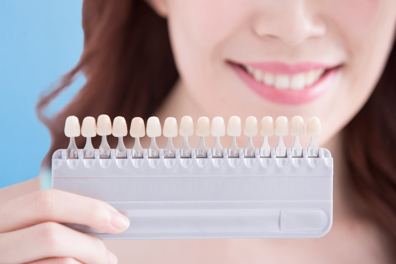Transform Your Smile with Porcelain Veneers: A Guide